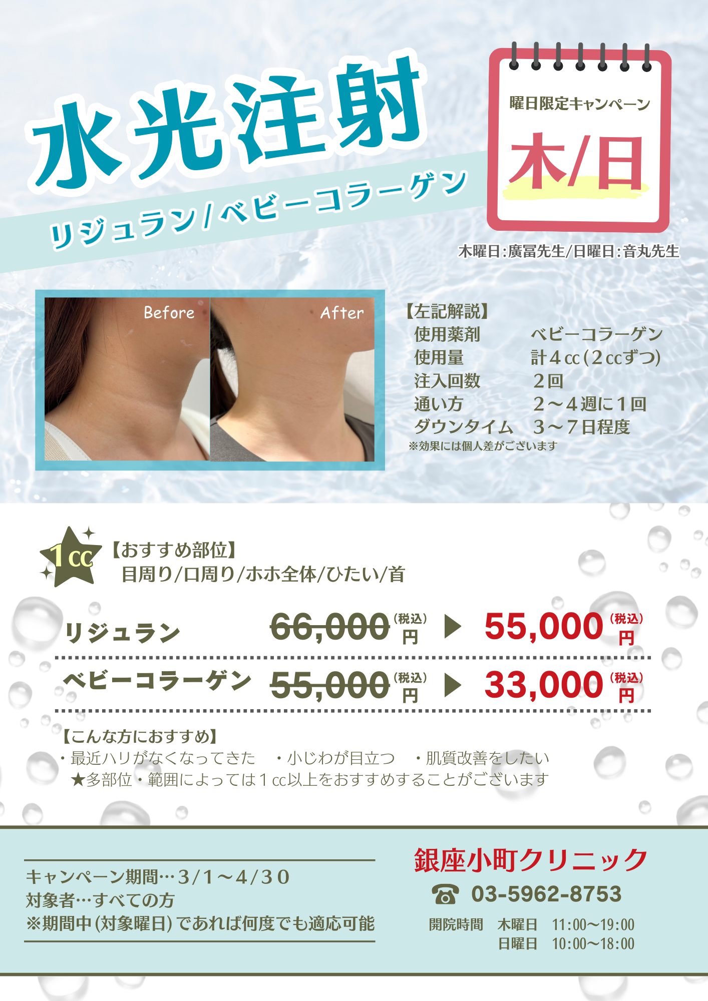 【木／日限定】水光注射キャンペーン
