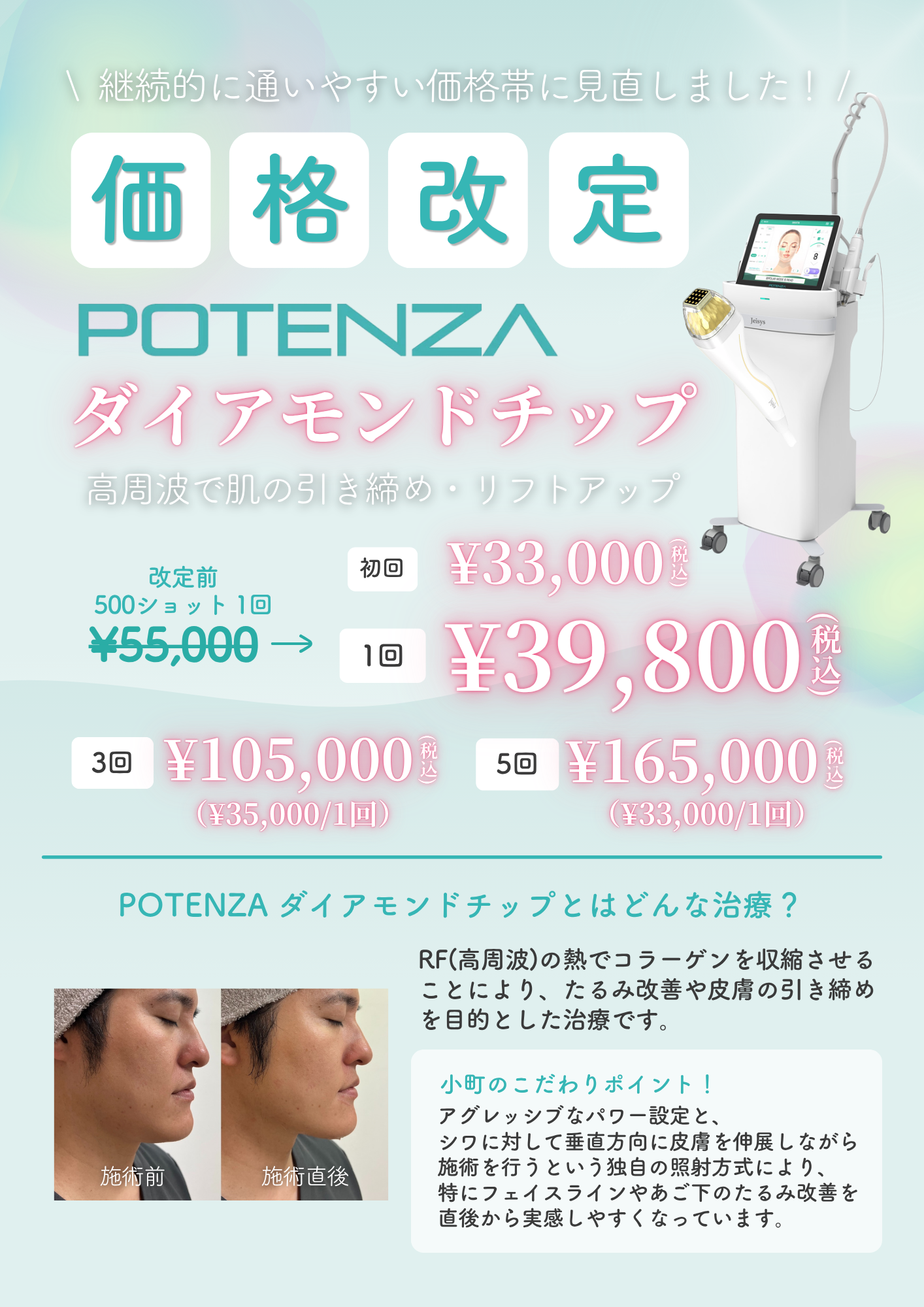 POTENZA ダイアモンドチップ　価格改定しました！
