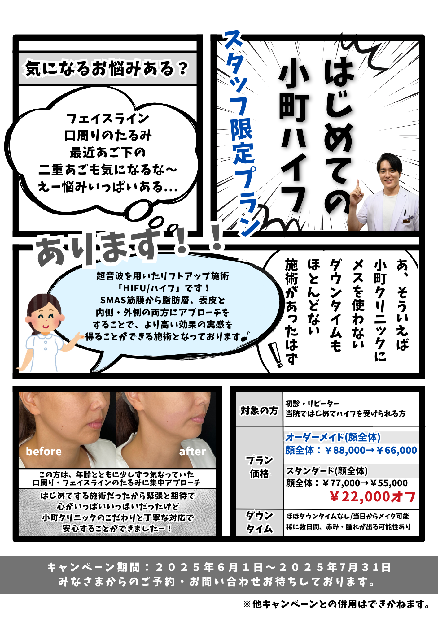 はじめての小町式HIFUキャンペーン