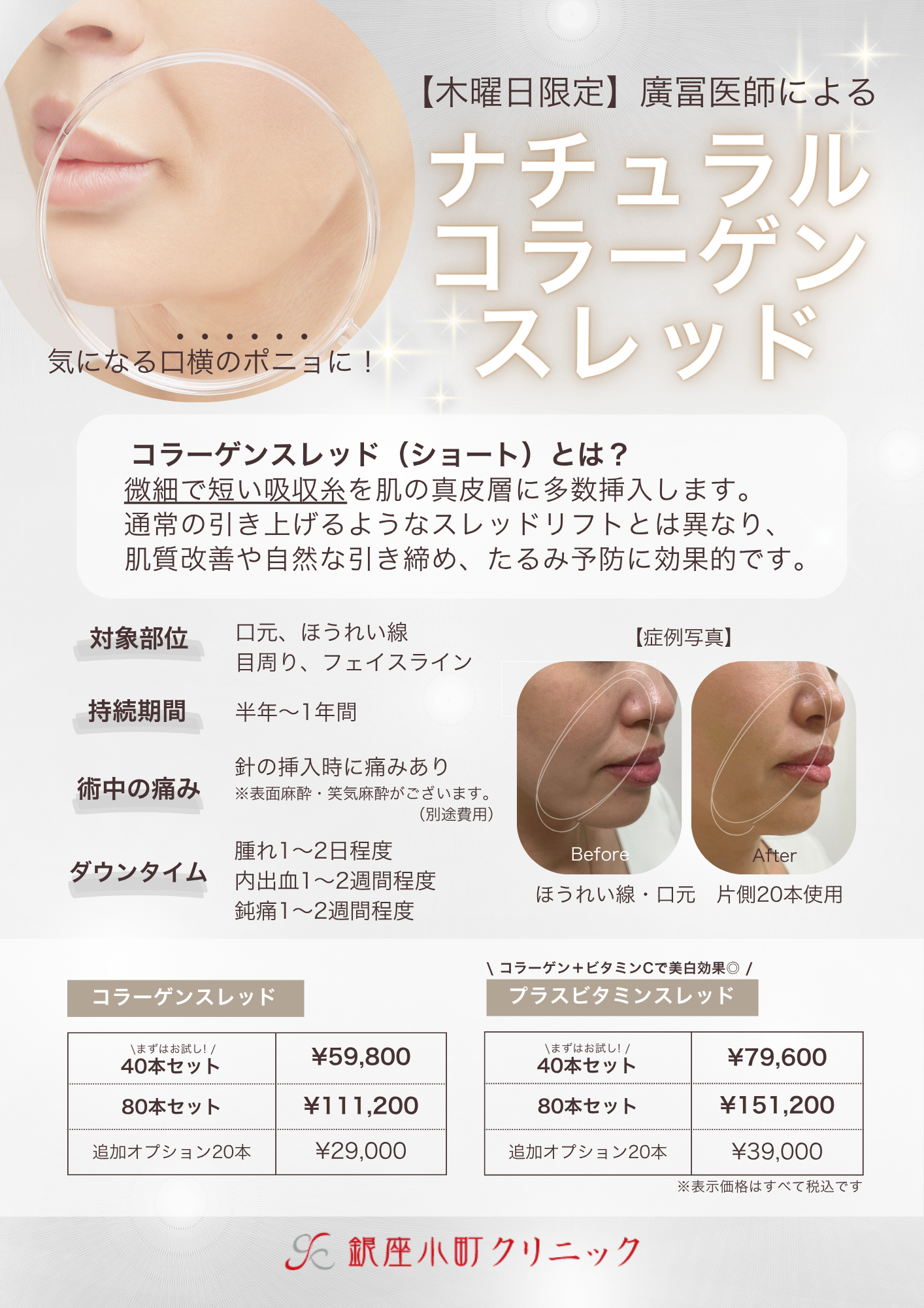 【木曜日限定】ナチュラルコラーゲンスレッド 【木曜日限定】ナチュラルコラーゲンスレッド