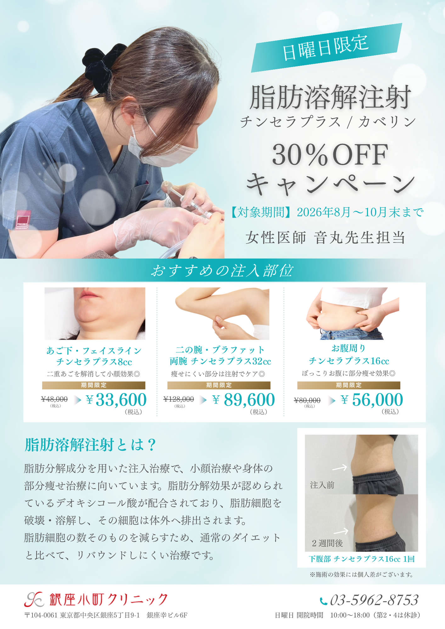 〈日曜日限定〉脂肪溶解注射30％OFFキャンペーン！